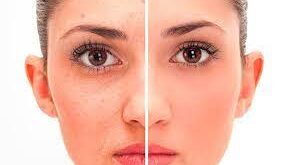 Free face editing app
